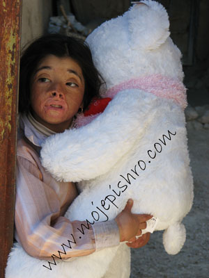 کودکان سوخته در مدرسه شهید رحیمی روستای درودزن